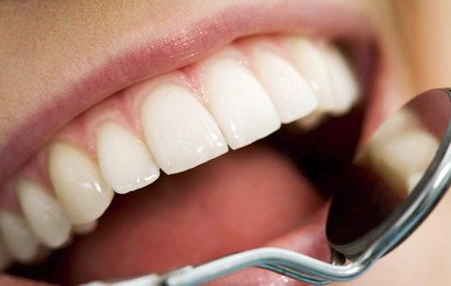 نسخه طبیعی برای مقابله با جرم دندان