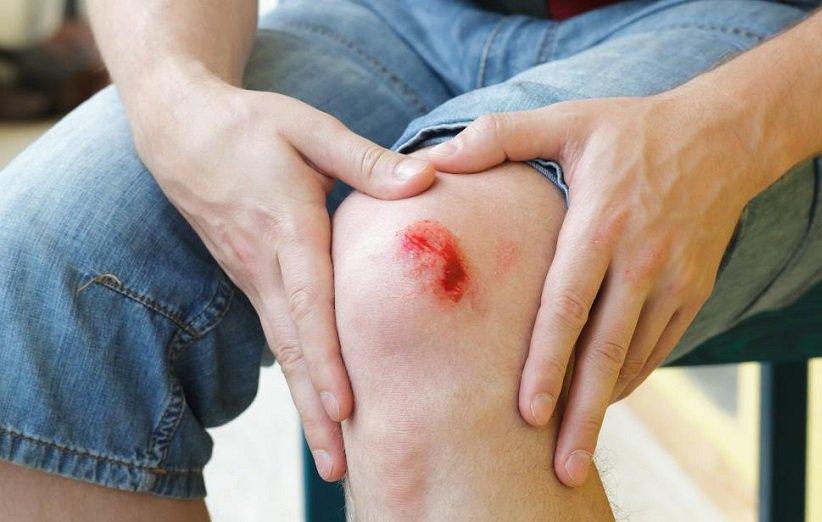 علائم عفونت زخم یا خراشیدگی را بشناسید