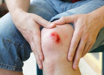علائم عفونت زخم یا خراشیدگی را بشناسید