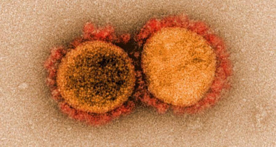 ویروس کرونا به سلول های قرمز خون آسیب می زند