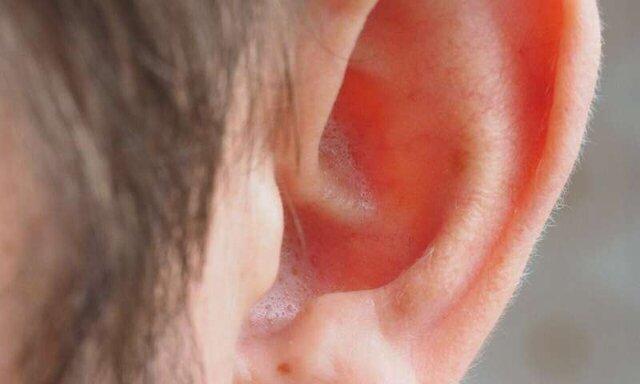 تاثیر از دست دادن شنوایی بر بروز فراموشی