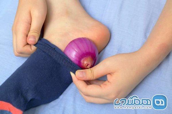 درمان سریع میخچه با قرار دادن پیاز کف پا داخل جوراب